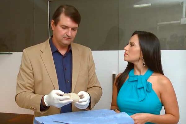 Dr. Edilson Pinheiro, cirurgião plástico em Fortaleza, abrindo uma prótese de silicone