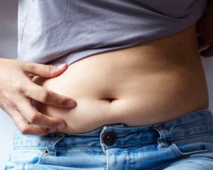 Mulher entendendo a abdominoplastia na barriga