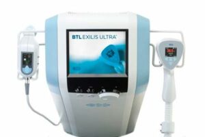 Exilis ultra 360 para o tratamento da papada