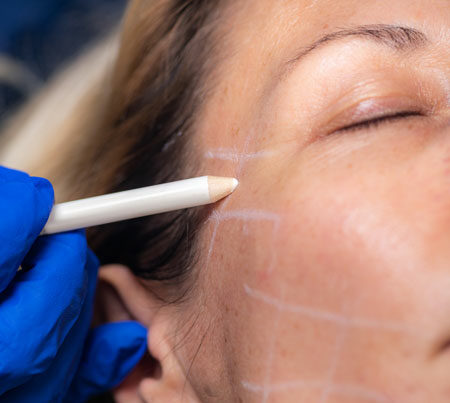 Tratamento estética pra prevenir o envelhecimento do rosto