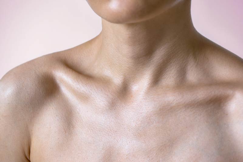 Rugas no pescoço | Como tratar o pescoço envelhecido | Tratamentos estéticos no pescoço